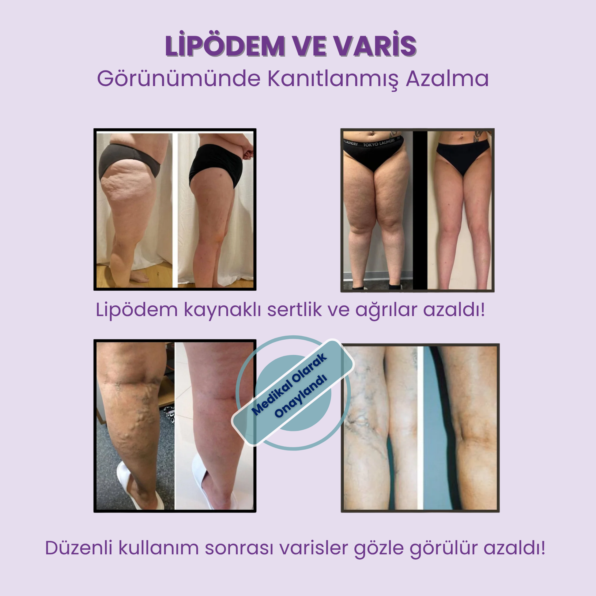 TaytiQ™ 3D Aktif Basınç Taytı